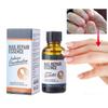 Nail Repair Essence Nourishing Protect Fingernail Toenail Anti Infection Nail Fungus Removal Gel