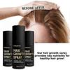 HaloGrow Hair Growth Spray with Biotin & Caffeine - Fast-Acting Hair Regrowth Treatment for Thinning Hair in Men and Women