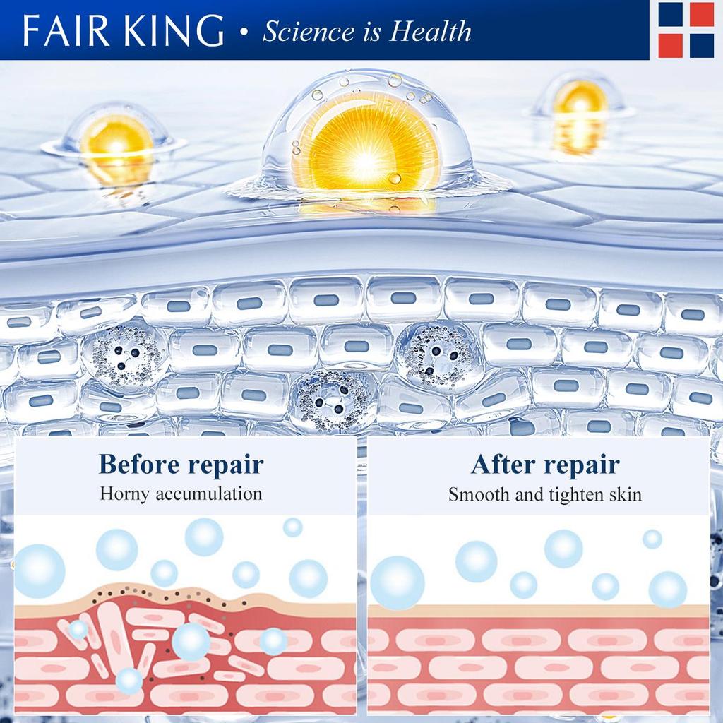 FAIR KING маска для лица против акне