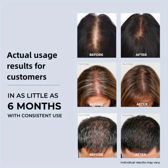 Шапочка для фототерапии с красным светом для восстановления здоровья волос 96 светодиодов Мужчины Женщины Лечение истончения волос Уменьшение перхоти Красные шапки для терапии ближним инфракрасным светом