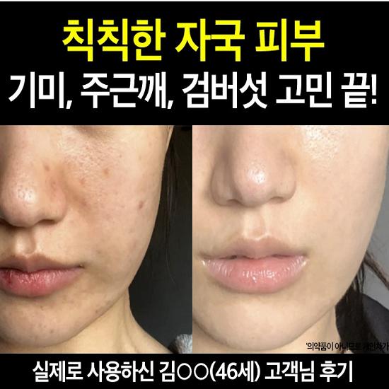 Крем от веснушек с глутатионом, пигментные пятна, веснушки, увлажнение, регенерация, увлажняющий, отбеливающий крем, 50 мл, 1 шт.