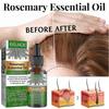 2pcs Rosemary Oil For Hair Growth,rosemary Essential Oil For Hair Growth & Skin Care,improve Hair Loss And Nourishes