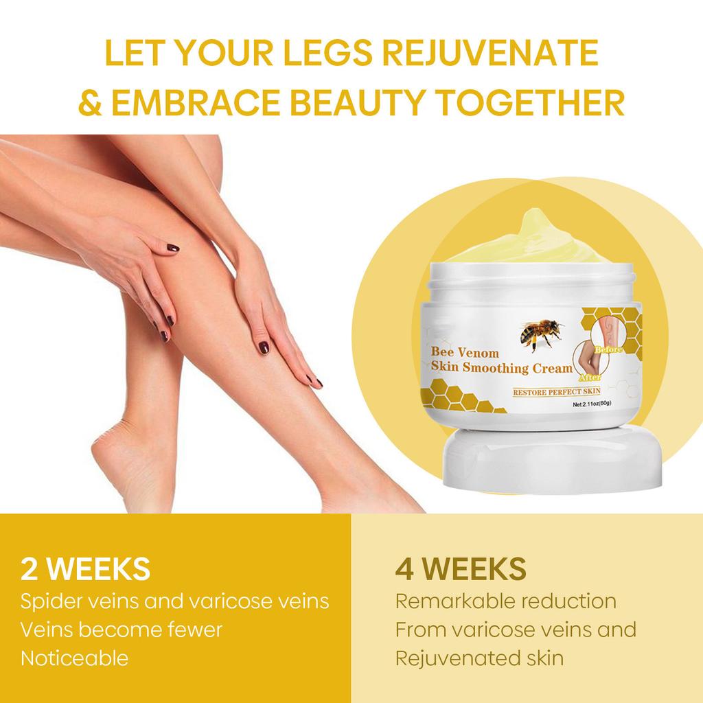 Venoheal Varicose Vein Ease Paste, Varicose Veins Paste, Varicose And Spider Veins Ease For Legs, Improve Blood Circulatio
