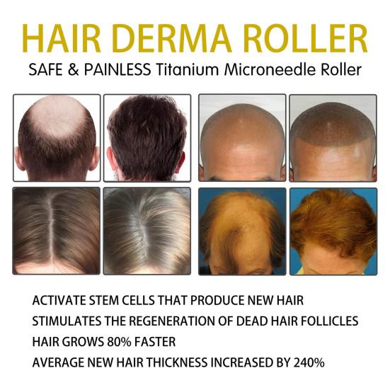 Ролик для роста волос, практичный, прочный, черный, женский, для домашнего использования, набор инструментов для красоты, принадлежности для ванной комнаты