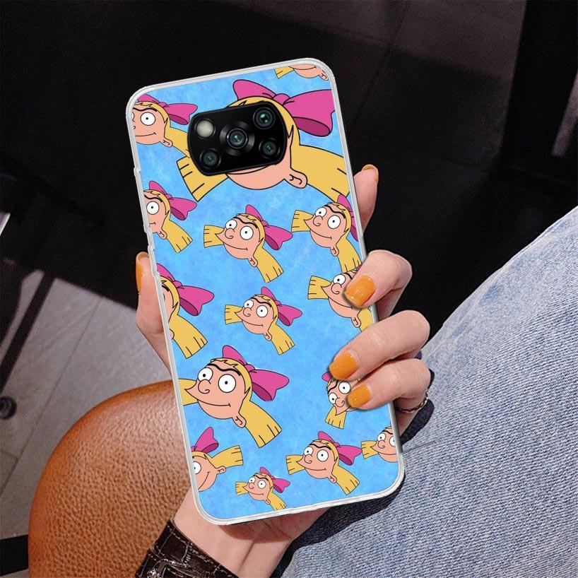 Мультяшный чехол Hey Arnold для телефона Xiaomi Poco X5 X6 X7 Pro X4 Gt F7 Ultra M8 M7 Redmi 15C 15 13C 13 12C 12 Уникальная крышка C