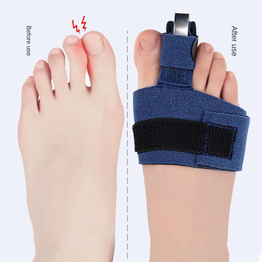 Arthritis Toe Care Tools Joint Stabilizer Toe Fix Strap Protector Foot Correction Brace Toe Splint