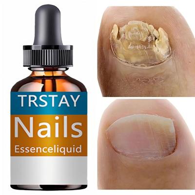 Чудо для ногтей: Укрепление, предотвращение расщепления, введение натурального кератина без запаха, придание блеска