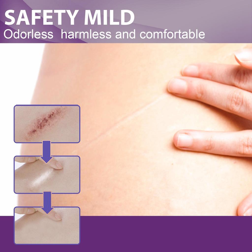 Silicone Scar Tape Scar Sheets for Removing Scars Adaptable Easy-Tear Scar Tape Reusable for C-Section