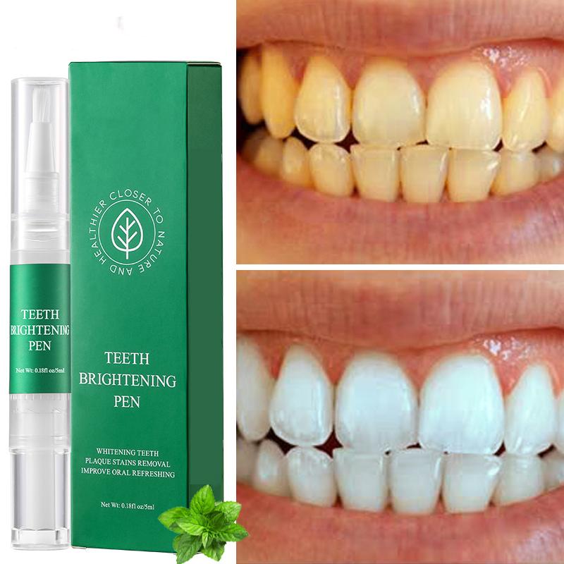 Ручка для отбеливания зубов, удаление пятен с зубов, удаление налета, черный цвет, отбеливание зубов, свежее дыхание, очистка рта, портативный уход за полостью рта