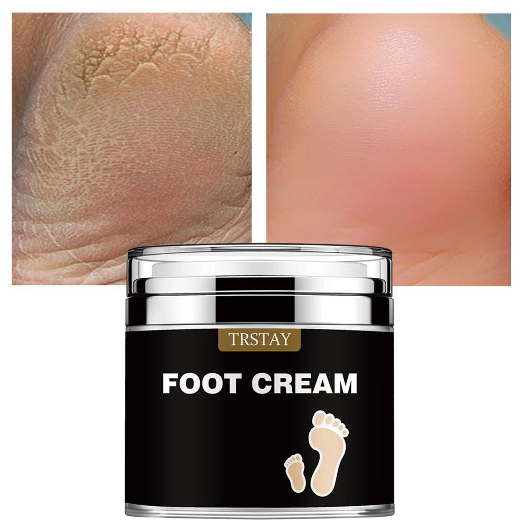 Heel Dry Crack Anti Wrinkle Softening Cream Tightens, Fades, Repairs Fine Lines On Hands and Feet, Eliminates Dead Skin, and Rejuvenates Cracks
