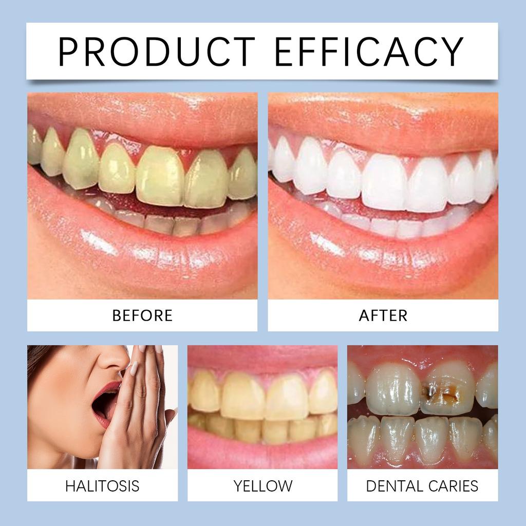 Mouth Freshener Spray Freshener Mouth Temperature And Comfort Say Goodbye To Dry Mouth During The Day Fresh Night Soothing50ml