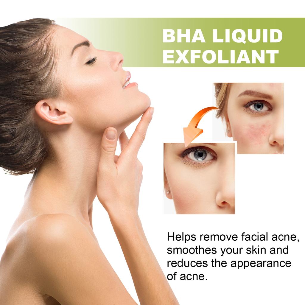 Eelhoe Tea Tree Anti-acne Essence Reduces Acne Pimples Fine Lines Clears Skin Tightens Pores And Moisturizes Skin Essence