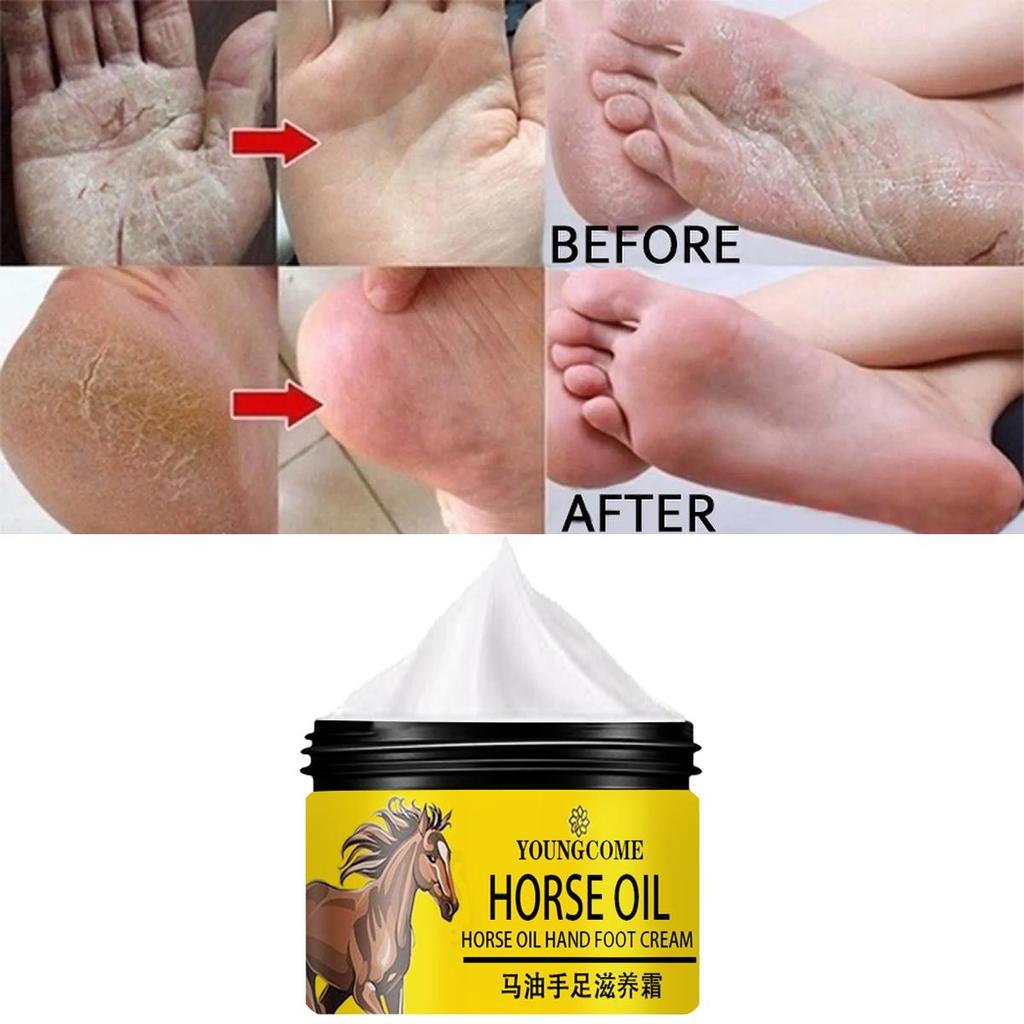 Gentle and Non-irritating, the Chapped Foot Repair Cream Hydrates and Nourishes the Skin, Leaving It Soft and Delicate