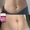 Powerful Stretch Mark Remover Essential Oil Pregnancy Marks Scar Removal Maternity Smooth Skin Body Repair Cream
