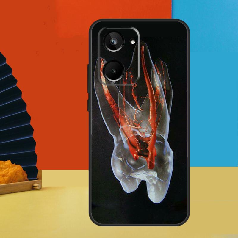 Рисунок с зубами для стоматолога Для Realme GT7 Pro GT6 10 11 12 13 14 15 Pro Plus C55 C67 C63 C61 C53 C31 C65 C71 C75 Чехол