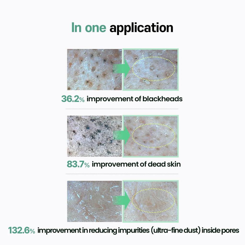 Ilso Natural Мягкое очищающее масло, специальный набор 200 мл (+30мл)