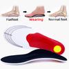 1Pair Orthotic High Arch Support Insoles for Shoes Gel Pads Arch Support Flat Feet For Women / Men Orthopedic Foot Pain
