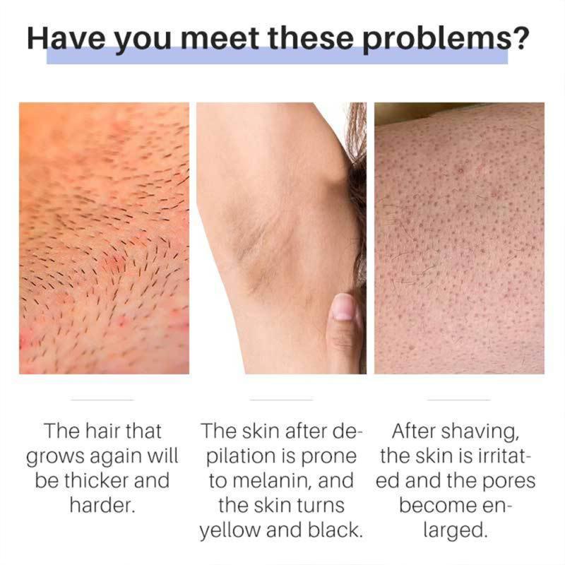Ингибитор роста волос Лосьон для тела, подавляющий волосы Эффективное безболезненное удаление волос Увлажняющий