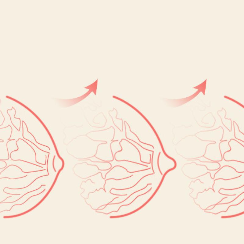 Силиконовые соски, ортопедические соски для подростков, перевернутые втягивающие соски, перевернутые плоские присоски