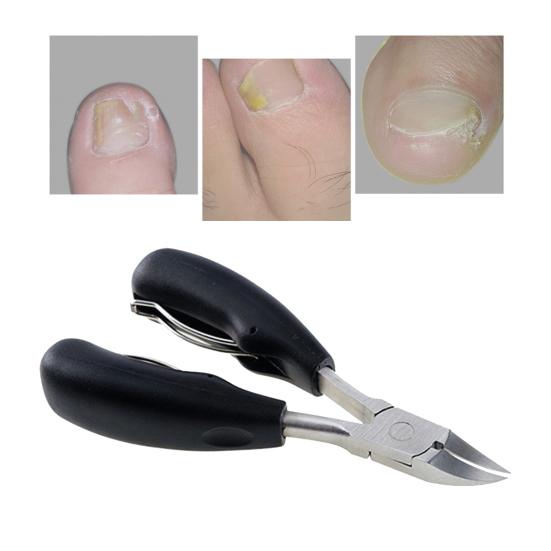Профессиональные кусачки для ногтей с резиновой ручкой для вросших или толстых ногтей хирургического класса