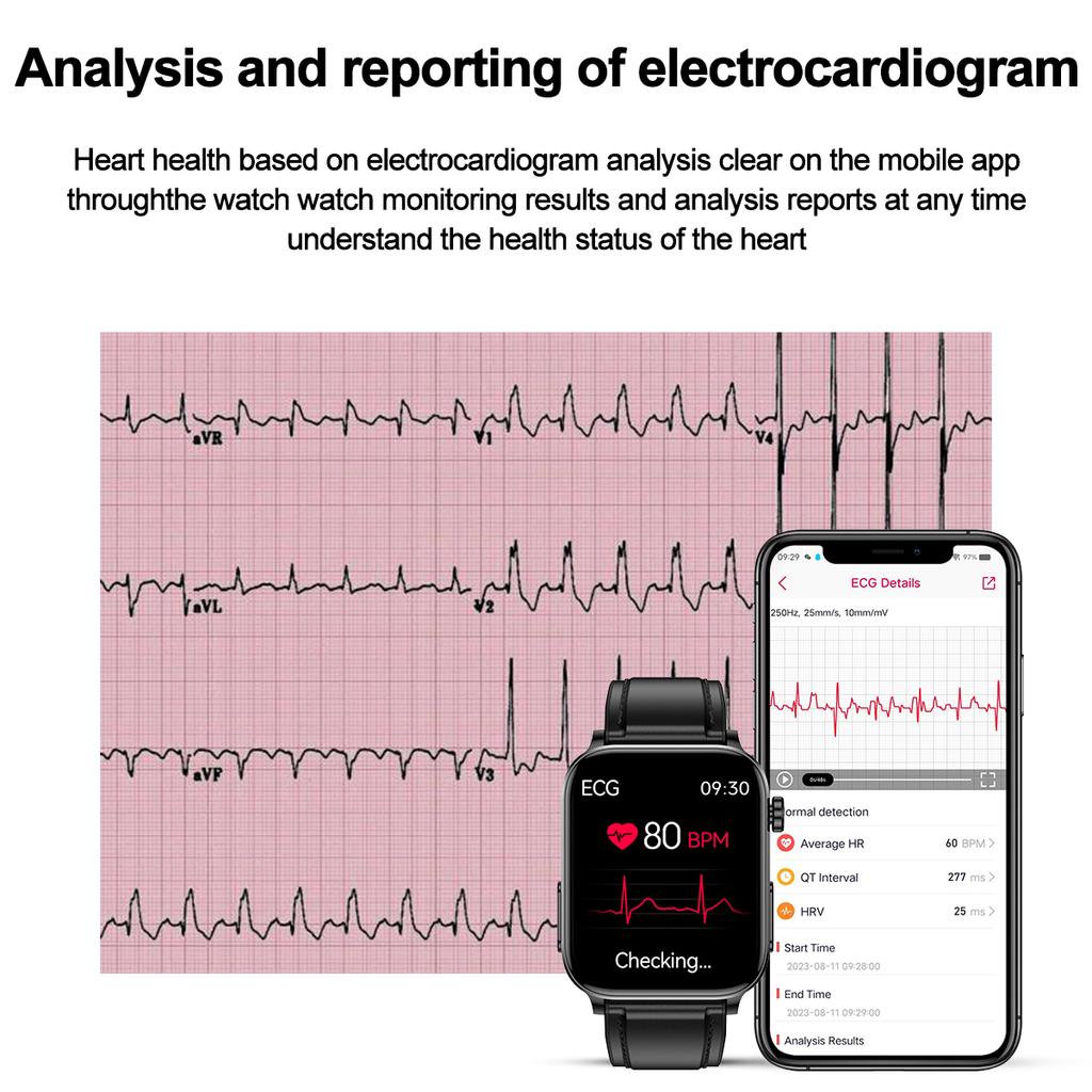 SACOSDING Смарт-часы для мужчин AI Voice Heart Rate ECG+PPG Blood Кислород Кровяное давление Кислород Крови Здоровье Женский умный браслет