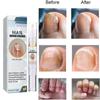 Exstroyeza Pen FUNGAL NAIL PEN Масло для ногтей 5 мл