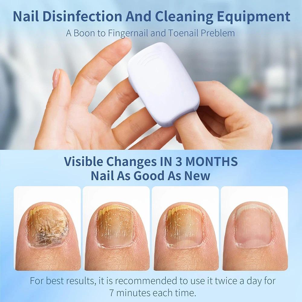 Удобная УФ-лампа для удаления грибка ногтей Эффективное лазерное устройство для лечения грибка ногтей Домашнее использование