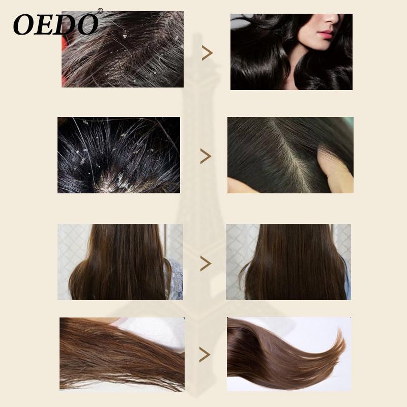 OEDO Марокко Травяной эластичный шампунь против перхоти Уход за волосами Смывает грязь и перхоть Улучшает сухость волос Блокирует воду Гладкая Мягкая