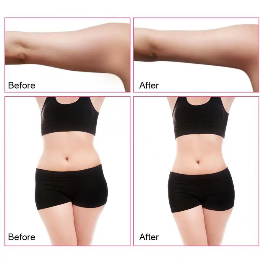 40K Lipo Cavitation Ultrasonic 3 in 1 Slimming Machine for Fat Removal, Anti Cellulite Weight Loss Skin Tightening