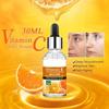 Fdit Sérum VC Disaar 30ml Sérum de Vitamine C Rétrécissement des Pores Sérum Visage Éclaircissant Hydratant
