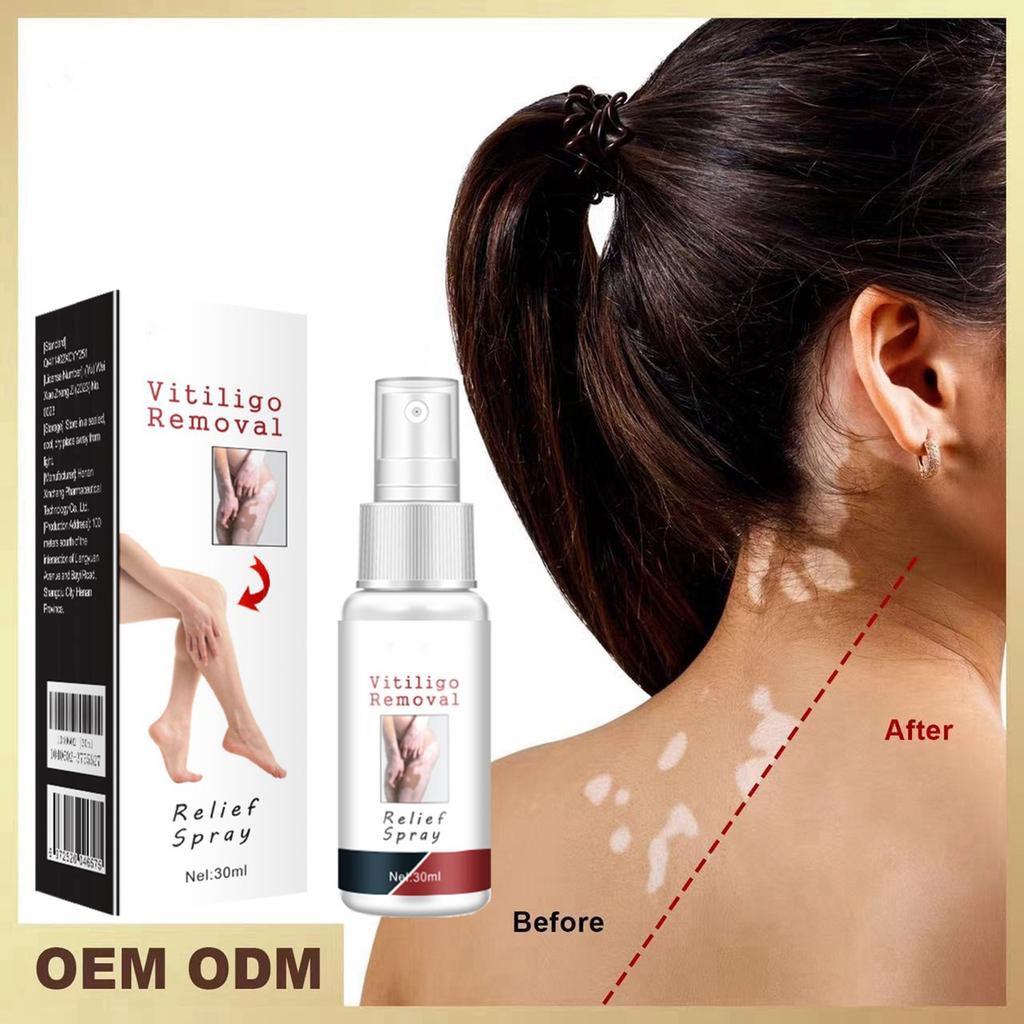 30 мл Белый очищающий спрей Psoralea Corylifolia Белый очищающий спрей Жидкий уход за кожей