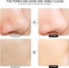 4 in 1 Skin Spatula Face Scrubber, Multifunctional Blackhead Remover with Ultrasonic Vibration for Deep Pore Cleansing Tool