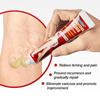 1/3/5pcs Sumifun Hot Varicose Veins Treatment Cream 100% Original Vasculitis Phlebitis Spider Pain Relief Ointment Medical Plaster