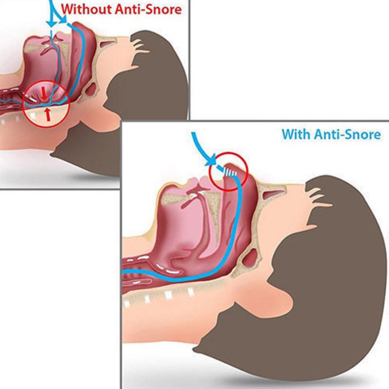 Анти-храп, пробка для храпа, носовые расширители, устройство для помощи при апноэ, зажим для носа, легкий сон