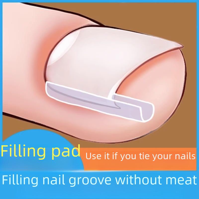 Пластыри для коррекции вросшего ногтя — пластыри для заполнения бороздок, изоляции и снятия воспаления.