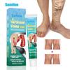 Varicose Veins Cream Herbal Ointment