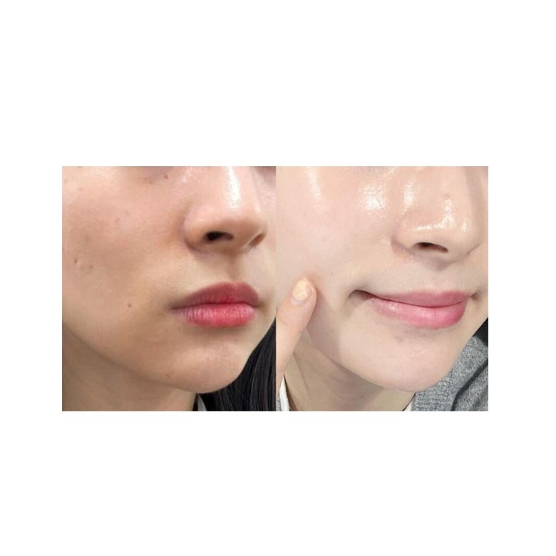 SHIMOMENT Glutathione Pearl Whitening Baek ok Ампула 30мл