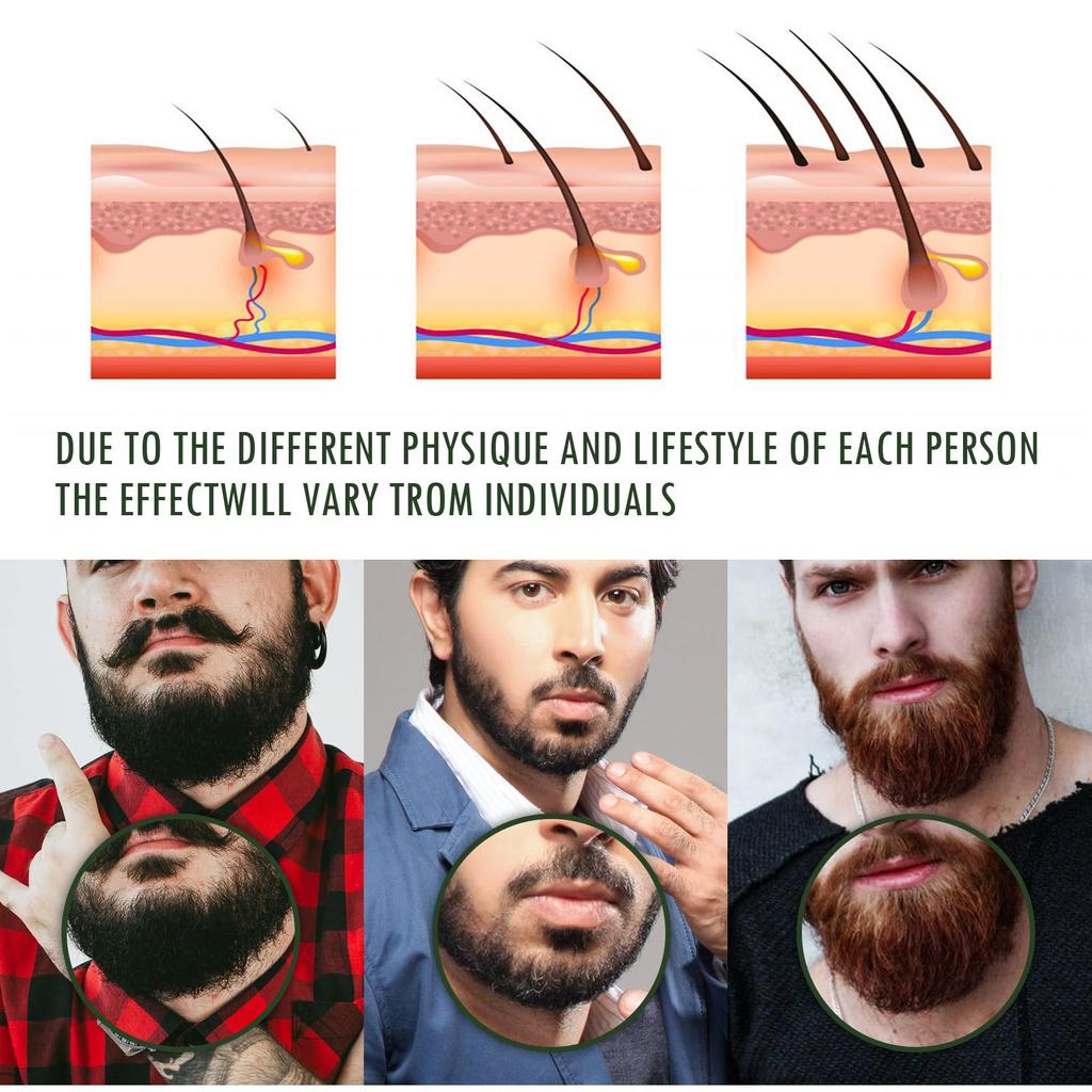 Men's Beard Oil Set – Deeply nourishes, smooths, moisturizes, and adds shine to beard hair while removing odor, showcasing masculine charm.