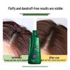 100 Year Runfa Anti-Dandruff Amino Acid Shampoo 750ml