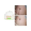 Best Organic Repair Scar Cream Natural Cellulite Removal Anti Pregnancy Stretch Marks Cream For Female