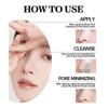 Blackhead And Whitehead Removal Tool For Nose And Face - Skin Pore Cleaner Skin Care Tools For Women