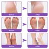 EELHOE Ginger Foot Mask Moisturizing Whitening Exfoliating Foot Mask Callus Remover for Feet Pedicure Spa Socks Natural Plant Skin Care
