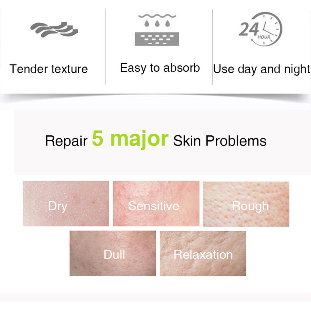 Легкий нежирный увлажняющий крем для лица для склонной к акне и чувствительной кожи