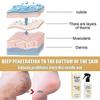 Foot Exfoliation Repair & Brightening Spray Remove Dead Skin Calluses Foot Rejuvenation Treatment 26s