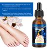 Масло для ногтей от бороздок 30 мл. Масло для ногтей от вросших ногтей, воспаление, поддержание здоровья ногтей, смягчение масла для ногтей от бороздок