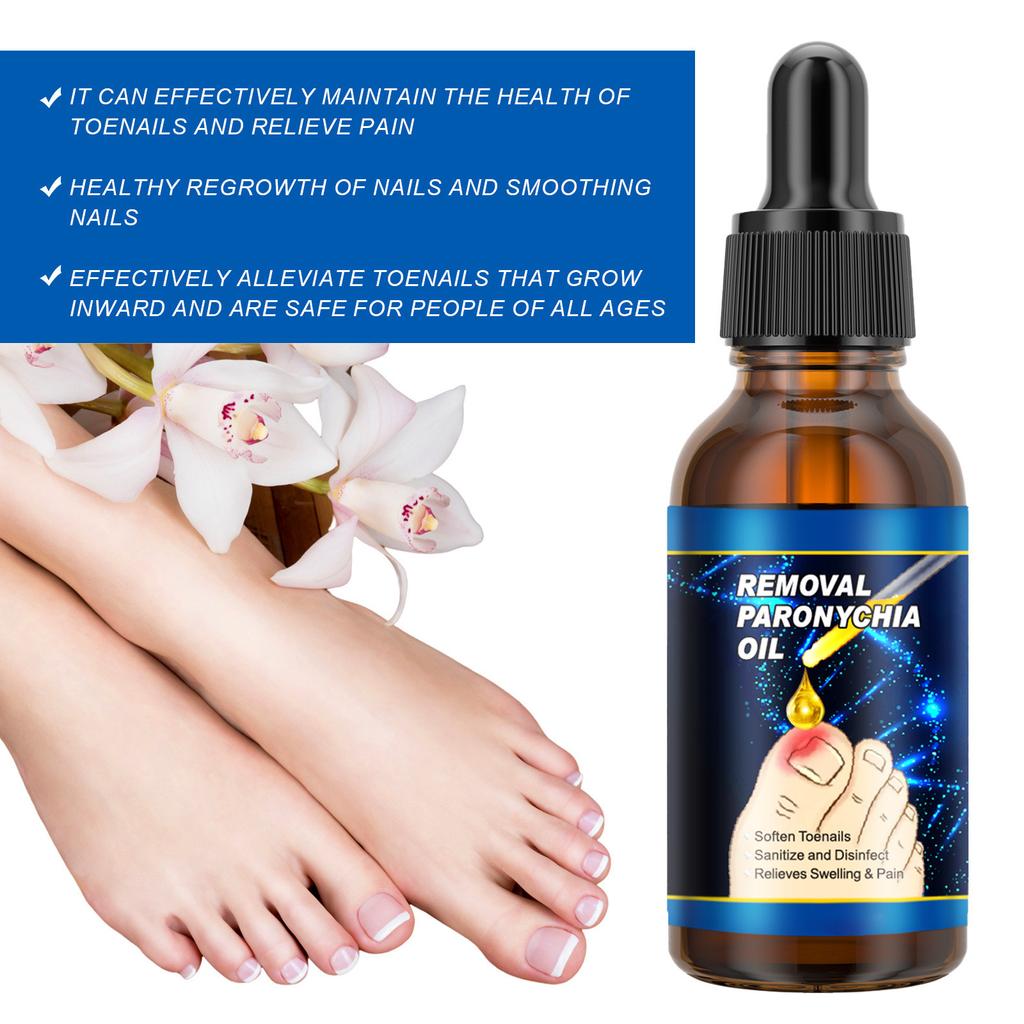 Масло для ногтей от бороздок 30 мл. Масло для ногтей от вросших ногтей, воспаление, поддержание здоровья ногтей, смягчение масла для ногтей от бороздок