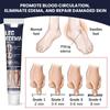 Anti-edema Cream Leg Swelling Edema Cream Arm Calf Foot Massage Health Care Plaster