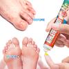 Sumifun 20/40/100 мл Крем для снятия зуда стоп Уменьшает запах пота шелушение Решает дискомфорт при грибке стопы Бактериостатическая мазь