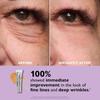 Мгновенный FIRMx® Eye Временный подтягиватель век Легко наносимая формула | Для подтяжки мешков и морщин под глазами