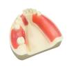 Dental Model Dentistry Implant Practice Training Model For Cutting Implant And Suturing Practice with Cancellous Bone Dental Lab